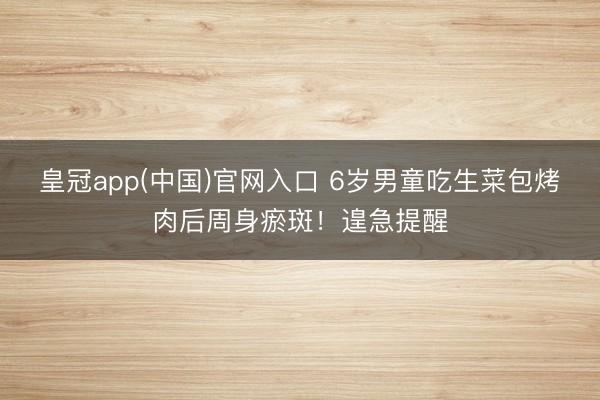 皇冠app(中国)官网入口 6岁男童吃生菜包烤肉后周身瘀斑！遑急提醒